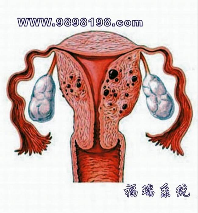卵巢图片
